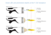 Pilt INTELECT FOCAL SHOCKWAVE SET - CHATTANOOGA